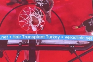 問啥詹姆斯！NBA籃板上沿有土耳其植發公司廣告 手動@杰倫-布朗